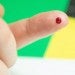 Cells may tell if arthritis flare-ups are coming